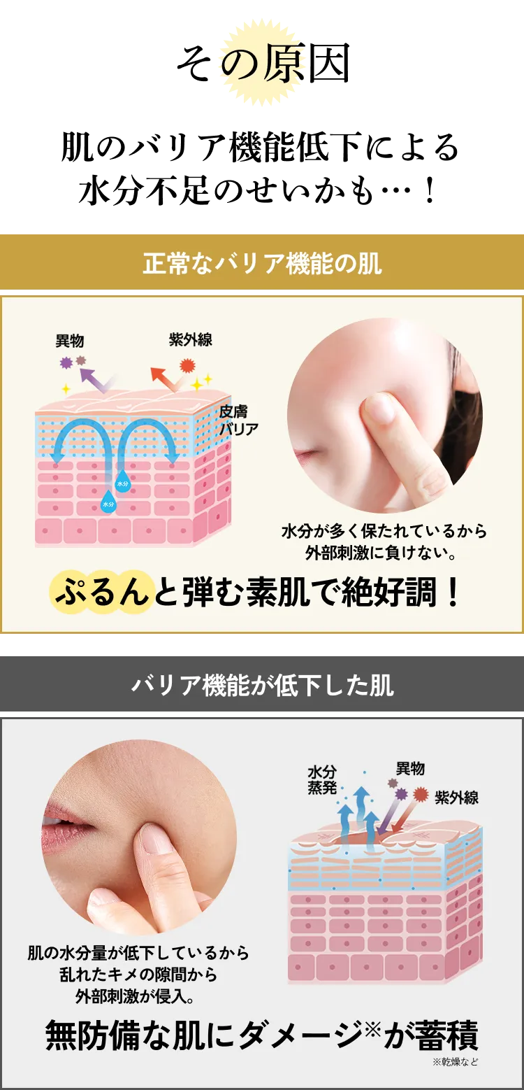 その原因 肌のバリア機能低下による水分不足のせいかも…！ 正常なバリア機能の肌:水分が多く保たれているから外部刺激に負けない。 ぷるんと弾む素肌で絶好調！ バリア機能が低下した肌: 肌の水分量が低下しているから乱れたキメの隙間から外部刺激が侵入。 無防備な肌にダメージ※が蓄積 ※乾燥など
